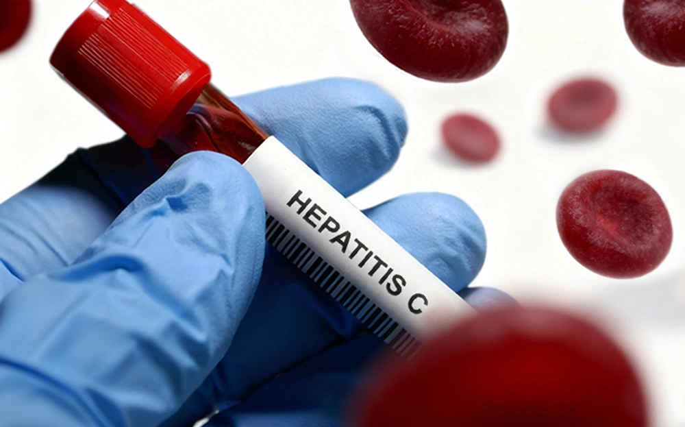 زمان مناسب برای آزمایش هپاتیت C