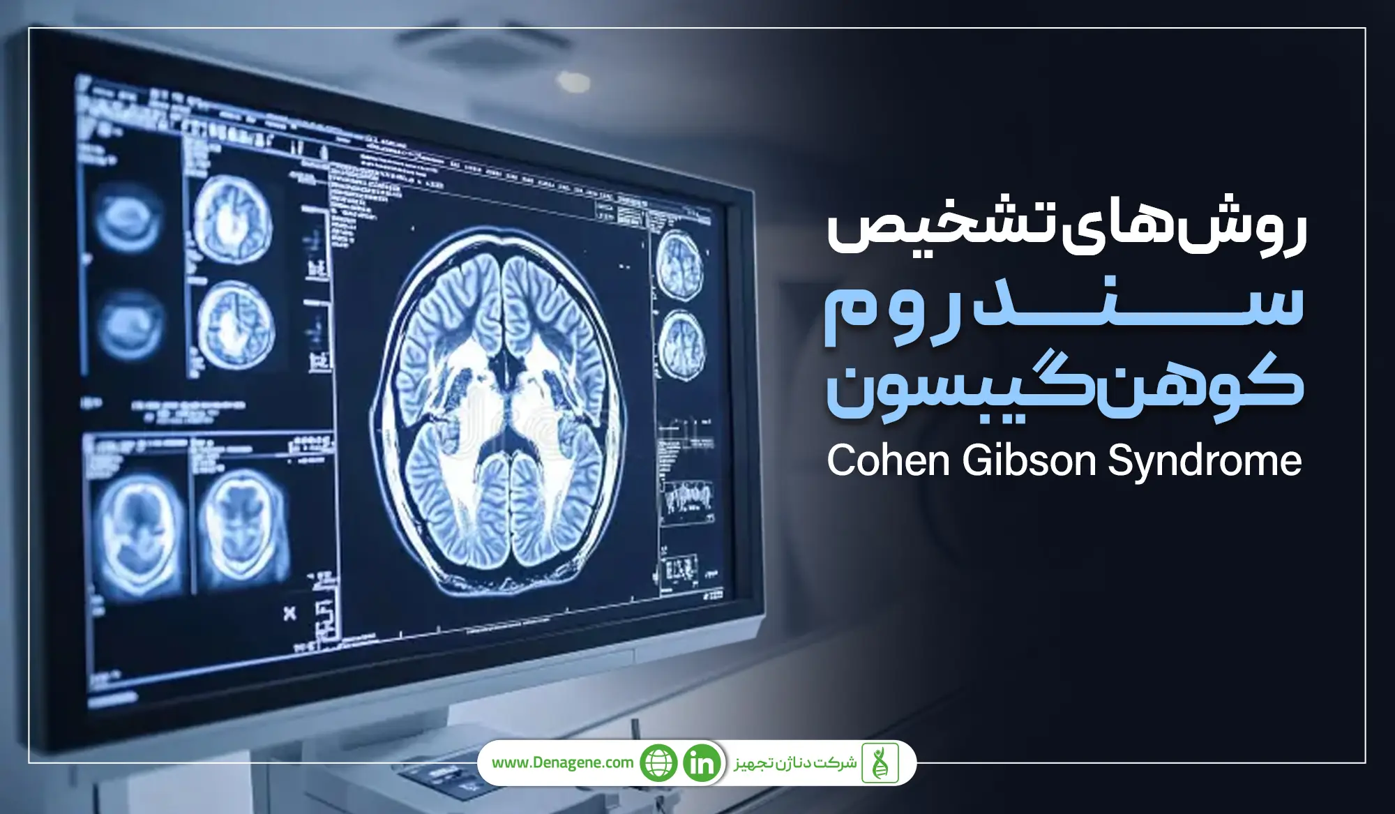 روش‌های تشخیص سندوم کوهن گیبسون